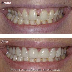 cosmetic laser dentistry 2000