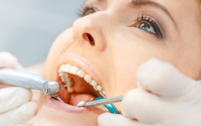 Your Trusted Dentist in Sydney CBD