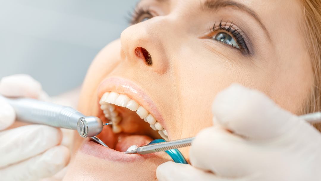 check teeth during smile makeover